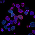 Fluorescent microscopy — cells viewed at high magnification on a glass slide